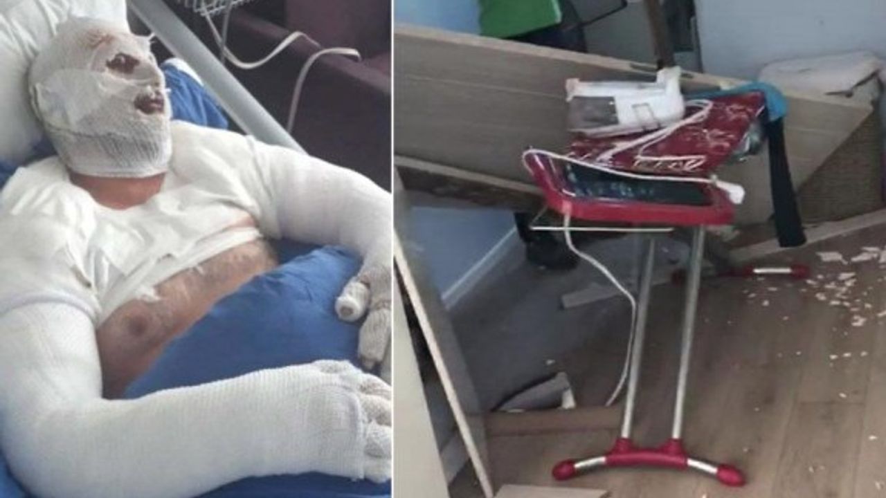 Saç kurutma makinesi bomba gibi patladı