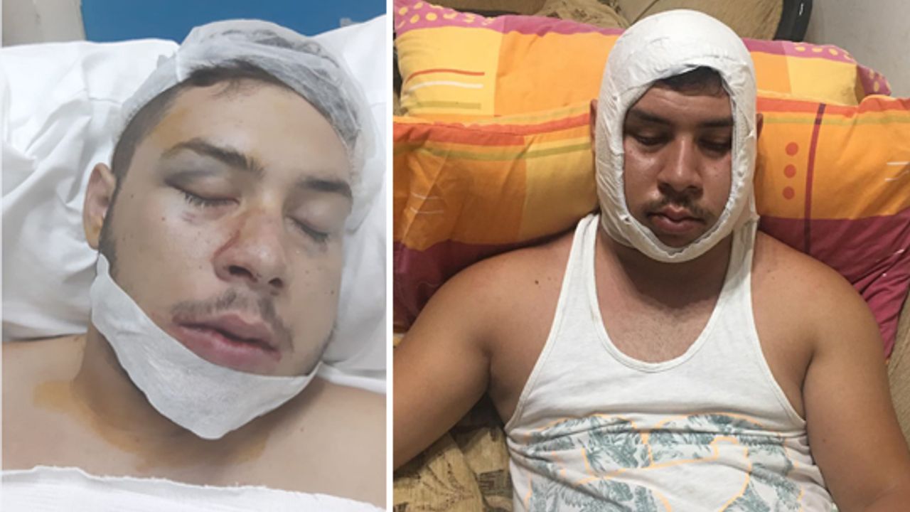 Sokak ortasında terör estirdiler