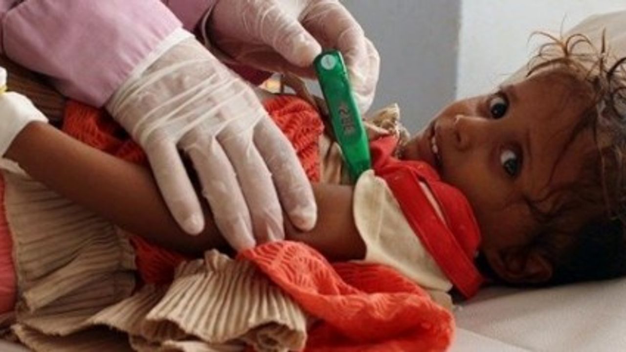 Yemen'de kolera aşısı kampanyası başlatıldı