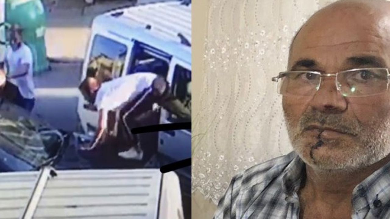 Öfkeli damat kayınpederinin dudağını ısırarak kopardı!