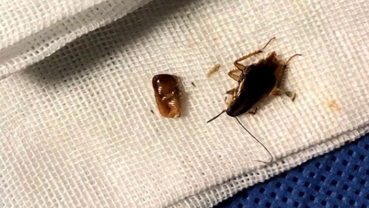 Çin'de genç adamın kulağından "hamam böceği ailesi" çıkarıldı