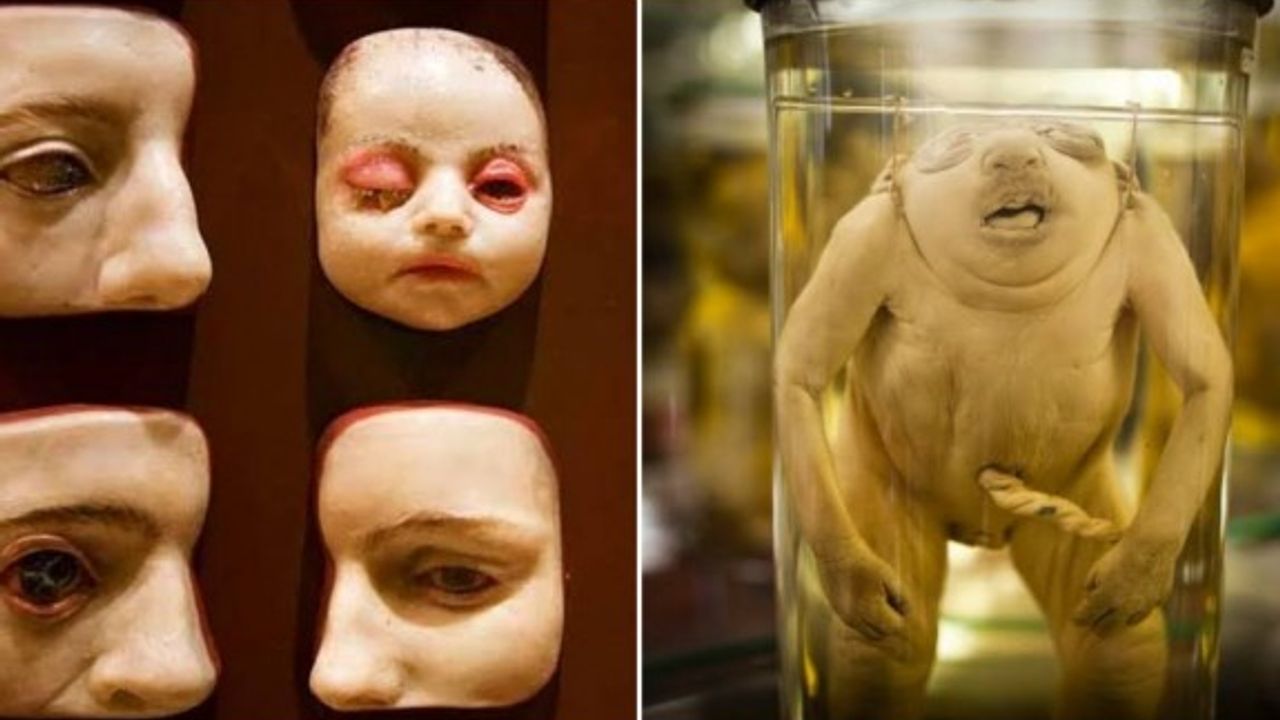 Tüylerinizi Diken Diken Edecek 11 Müze