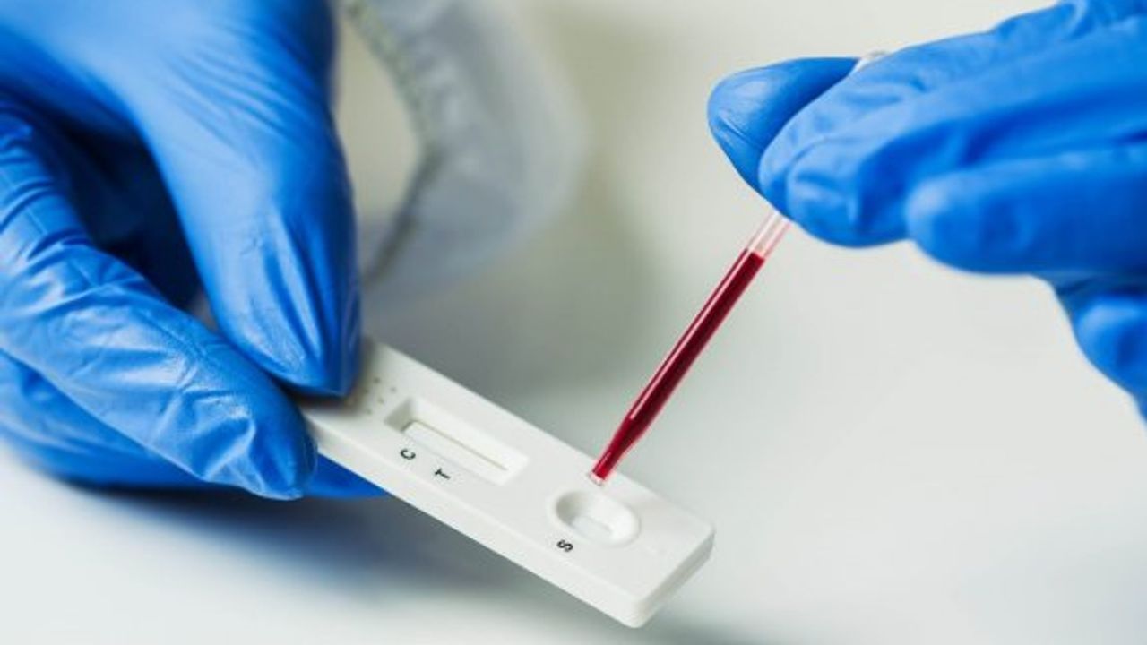 Avrupa Biyoteknoloji Kongresi’nden YDÜ'ye bir ödül daha