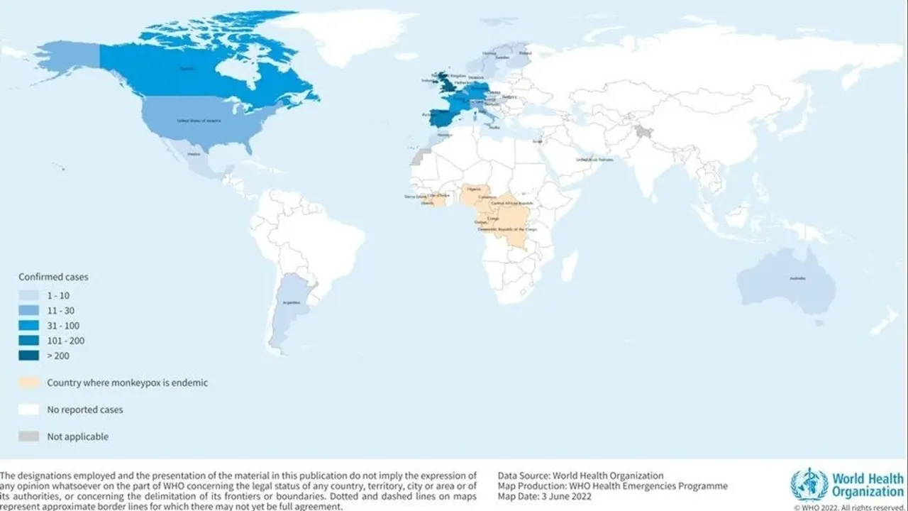 DSÖ, maymun çiçeği virüsünün ismini değiştiriyor