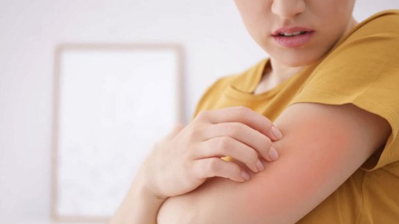 Kollarımda sivilce çıkıyor: Neden olur, nasıl geçer?