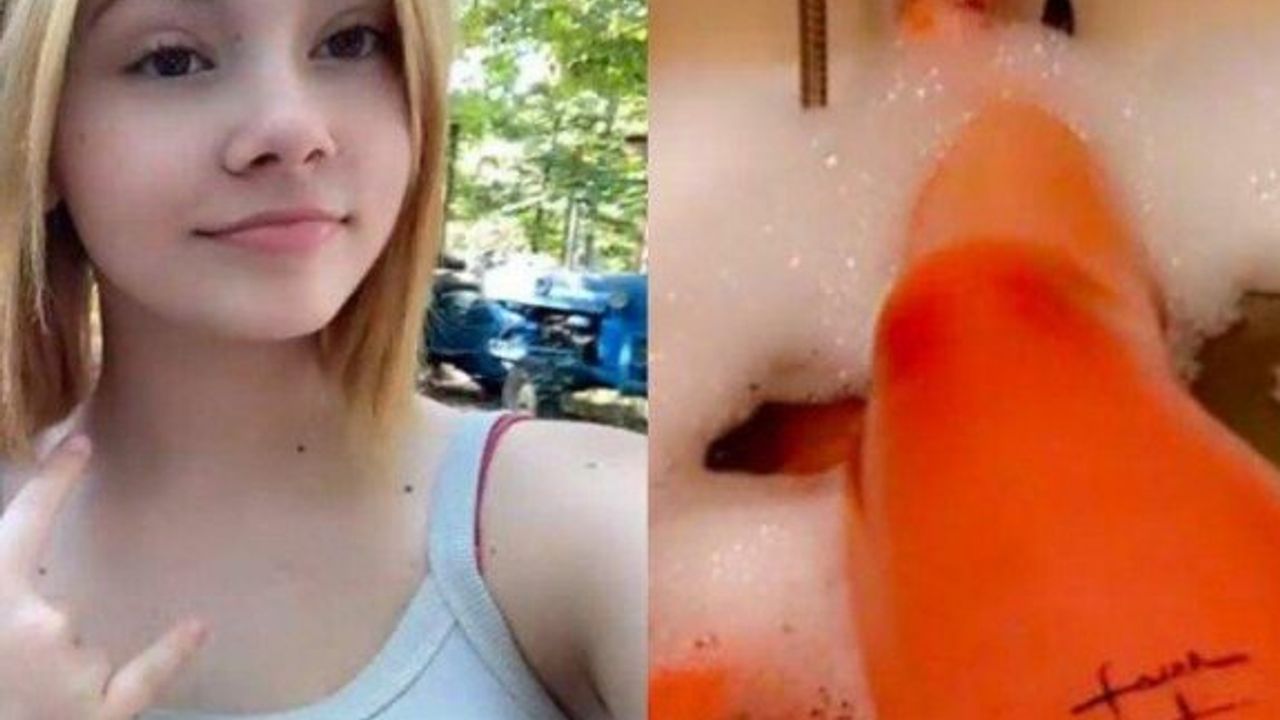 Suya alerjisi olan kızın hayatı kabusa döndü