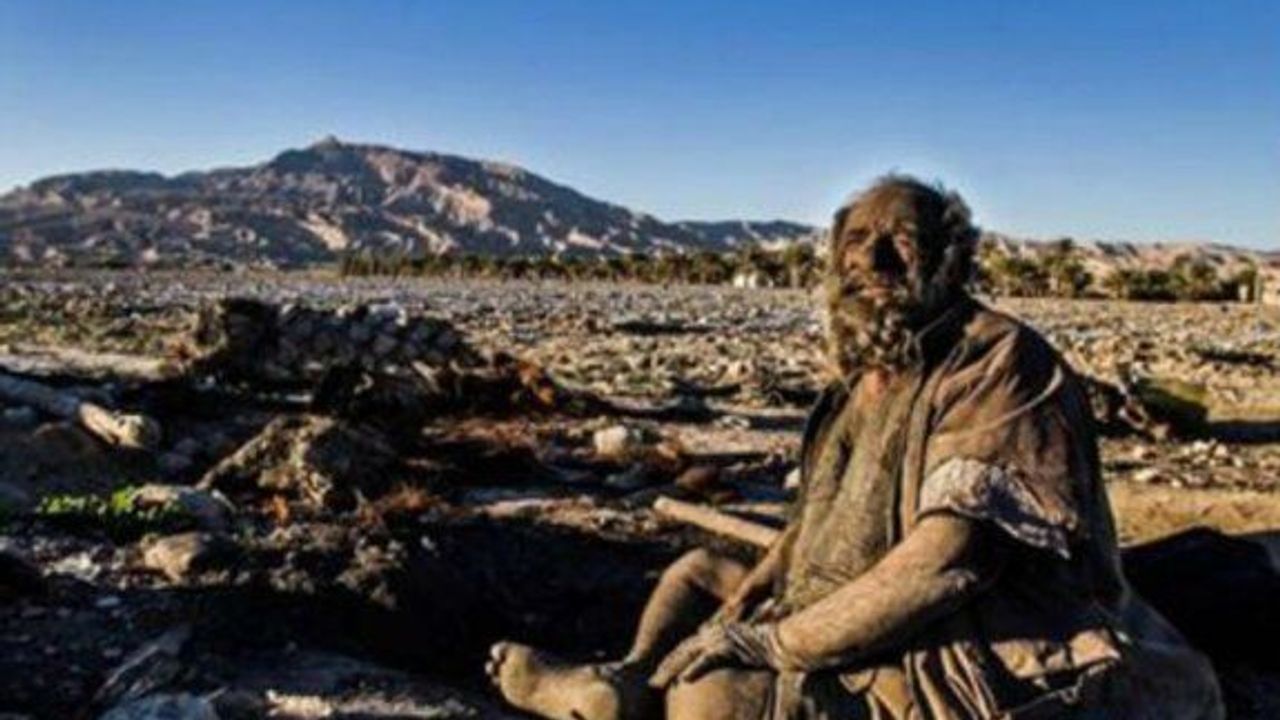 70 yıldır yıkanmayan adam, yıkandıktan sonra öldü!
