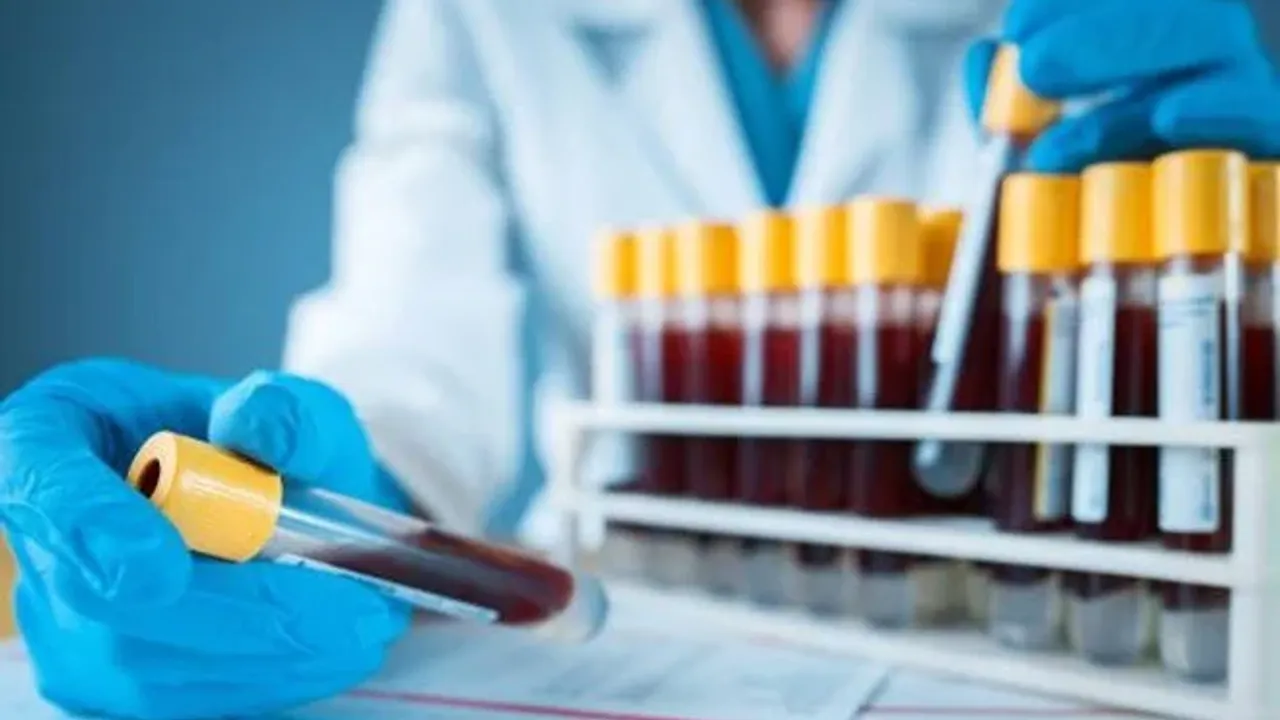 LYM (Lenfosit) nedir? Kan tahlili sonuçlarında LYM düşüklüğü ve yüksekliği ne ifade eder?