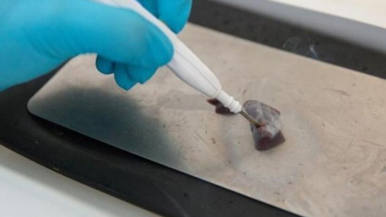 Tümör koklayan bıçak, rahim kanserini saniyeler içinde tespit edebilir