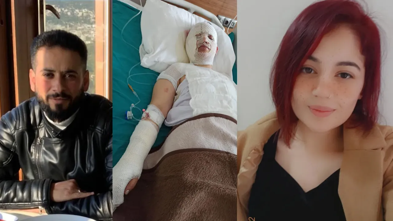 Depremzede eski eşini kaynar suyla yaktı