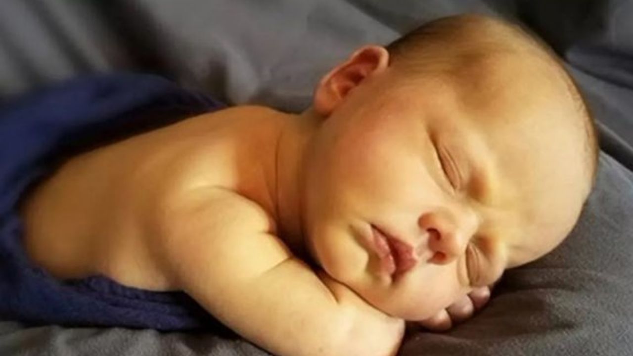 Yenidoğan sarılığı, doğru bir şekilde tedavi edilmezse beyin hasarına yol açabilir