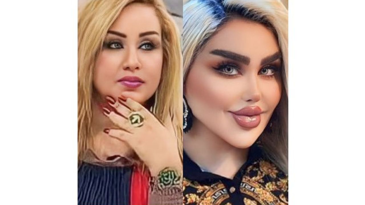 Barbie'ye benzemek isterken zombiye benzetildi