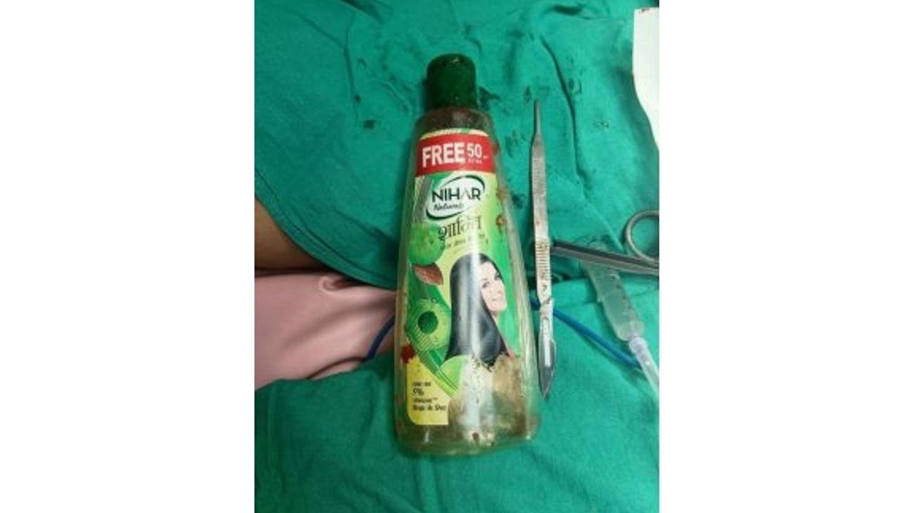 Tıp dünyasını şaşkına çeviren olay