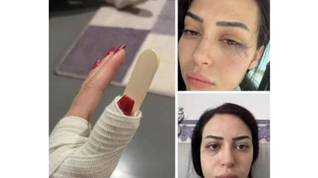 Kıbrıslı Türk genç kızın darp edilmesi olayında üçüncü bir şahıs aranıyor