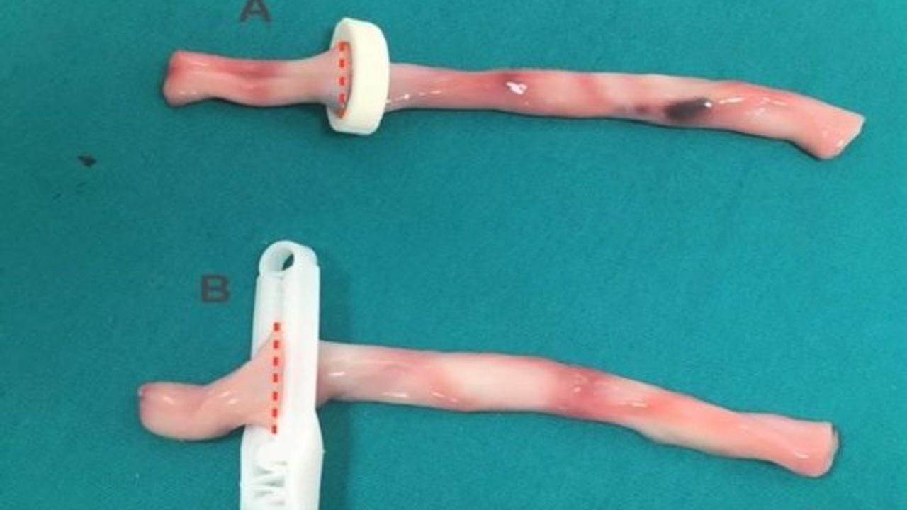 YDÜ’den yeni tasarım göbek kordonu