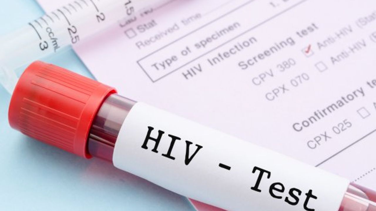 11 ayda 43 yeni AIDS hastası