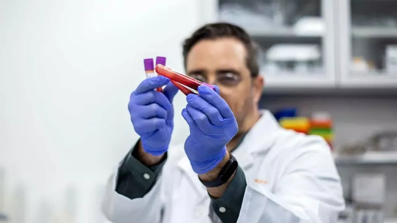 Rumların sağlık ve DNA haritası hazırlanıyor