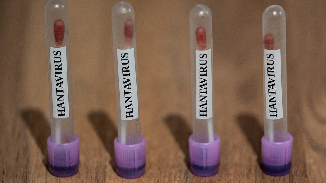 Sağlık Bakanlığı, hantavirüs görülen gemide KKTC vatandaşı bulunmadığını açıkladı