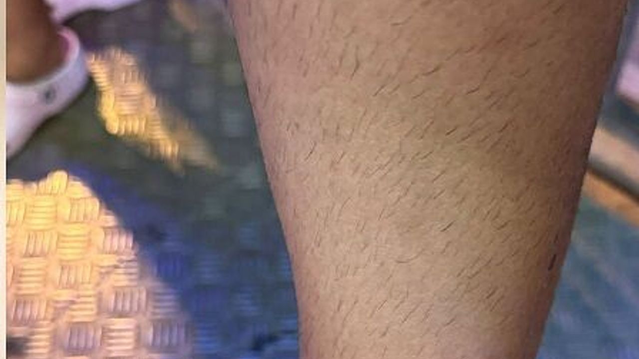 İskele Long Beach bölgesinde sinekler bezdirdi