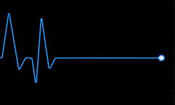 Ülkü Ülvier’in ölüm nedeni “beyin iltihabı”