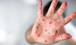 Yeni salgın dünyaya yayılıyor