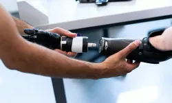 Güney Kıbrıs’ta bir hastaya biyonik el takıldı