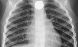 806 bin TL’lik kolyeyi yutarak çalmaya çalıştı