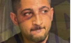 Polisleri yumrukladı