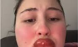 Kalıcı makyaj yaptırınca bu hale geldi