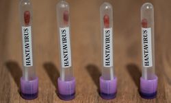 Sağlık Bakanlığı, hantavirüs görülen gemide KKTC vatandaşı bulunmadığını açıkladı