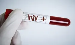 29 yılda 178 HIV pozitif vaka