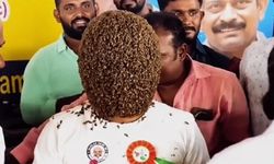 Yüzünü binlerce arıya kaptırdı