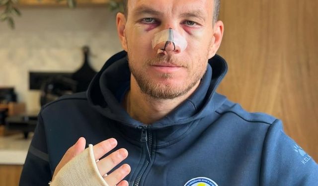 Edin Dzeko özel maske ile oynayacak