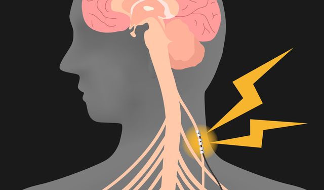 Parkinson hastaları için yeni umut