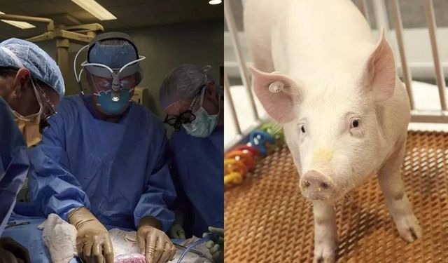 Tıp tarihinde bir ilk: Domuz akciğeri insana nakledildi
