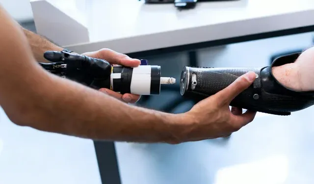 Güney Kıbrıs’ta bir hastaya biyonik el takıldı