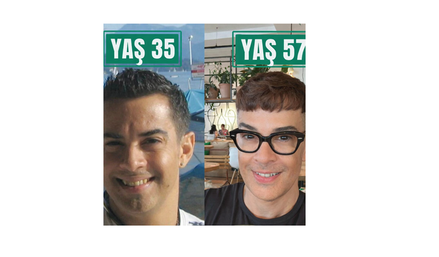 9 yiyecekten uzak durarak 30 yaş genç gösteriyor