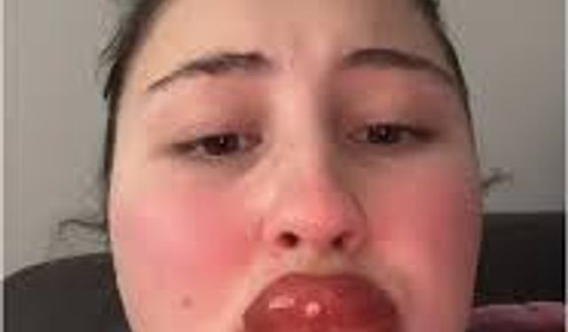 Kalıcı makyaj yaptırınca bu hale geldi