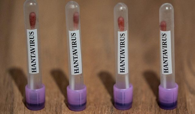 Sağlık Bakanlığı, hantavirüs görülen gemide KKTC vatandaşı bulunmadığını açıkladı