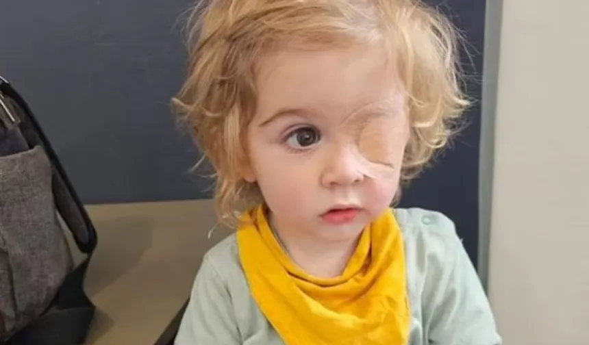Masum bir öpücük, 2 yaşındaki çocuğu kör etti