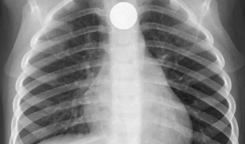 806 bin TL’lik kolyeyi yutarak çalmaya çalıştı