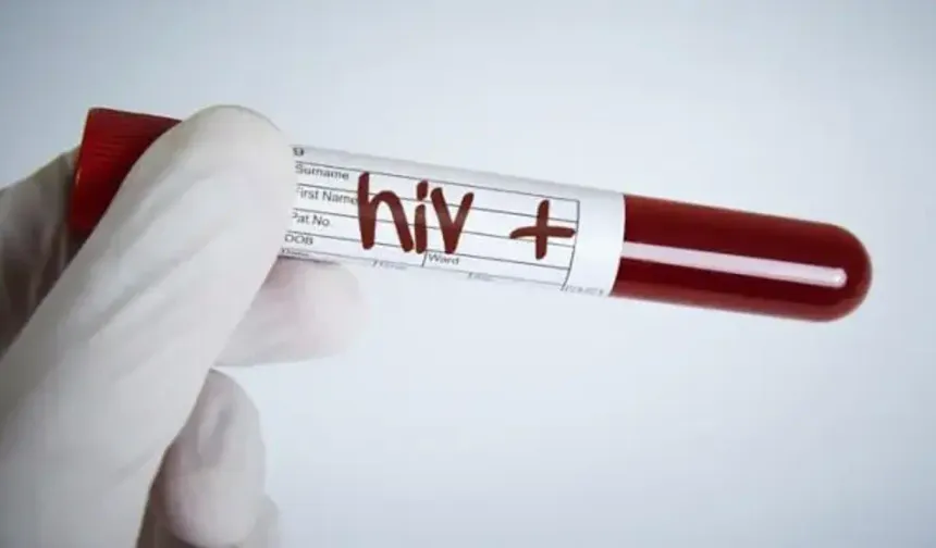 29 yılda 178 HIV pozitif vaka